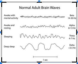Graph demostrating normal adult brainwaves. Retrain your brain to combat mental health symptoms with neurofeedback in NYC. Learn more here.