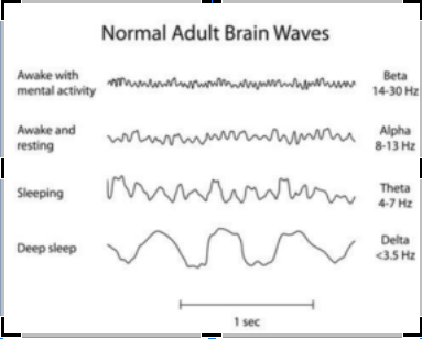 Graph of Normal Brain Waves in an adult. Interested in new forms of therapy to manage your ADHD symptoms? ATTN Center NYC uses different types of neurofeedback techniques in therapy. Click here to learn more!