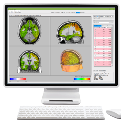 3D brain map created with LORETA neurofeedback in NYC. Different types of neurofeedback are available to help mitigate the symptoms of ADHD and related mental health issues. Learn more here. 